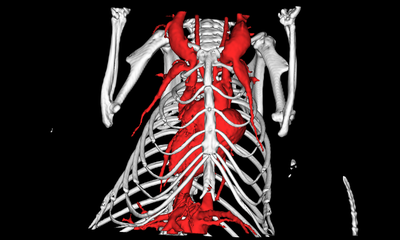 applications_vascular.png